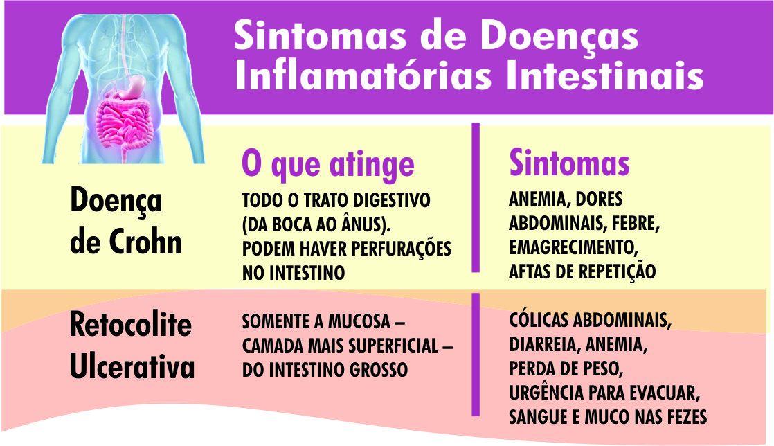 Doenças Inflamatórias Intestinais Sintomas Inespecíficos Dificultam Diagnóstico Boqnews 